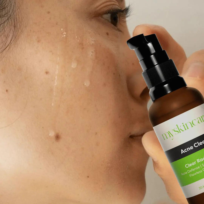 Clear Radiance Serum - My Skincare